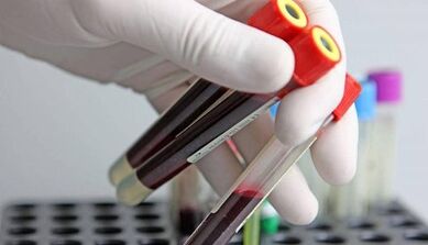Kā veikt ķermeņa parazītu testus