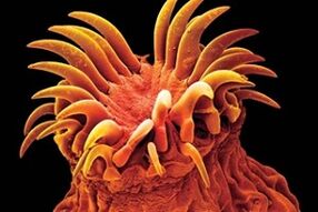 Trematodes parazīti cilvēkiem