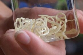 parazīti no cilvēka ķermeņa