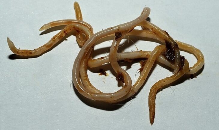 toksokaru no cilvēka ķermeņa